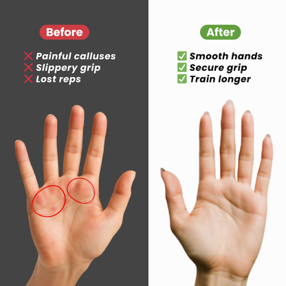 GRYPX™ Anti-Slip Palm Guards